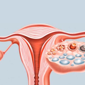 Nutricionista em Brasilia Nutricionista Nutricionista boa Nutricionista bem avaliada Ana Teixeira nutricionista para saúde da mulher nutrição para SOP e endometriose plano alimentar para menopausa recomposição corporal feminina acompanhamento nutricional para lipedema nutricionista especializada em hormônios femininos nutrição individualizada para mulheres caneta emagrecedora e plano alimentar nutricionista especializada em emagrecimento acompanhamento nutricional em Brasília